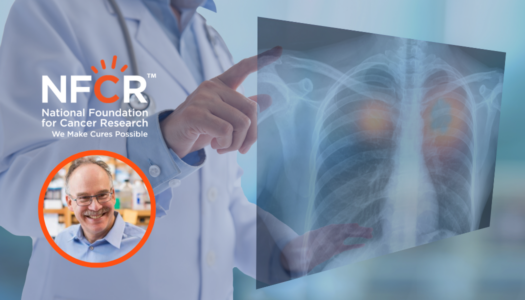 Progress in Precision Treatment for Small Cell Lung Cancer Thanks to NFCR Support