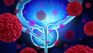 shutterstock_293521535 Prostate